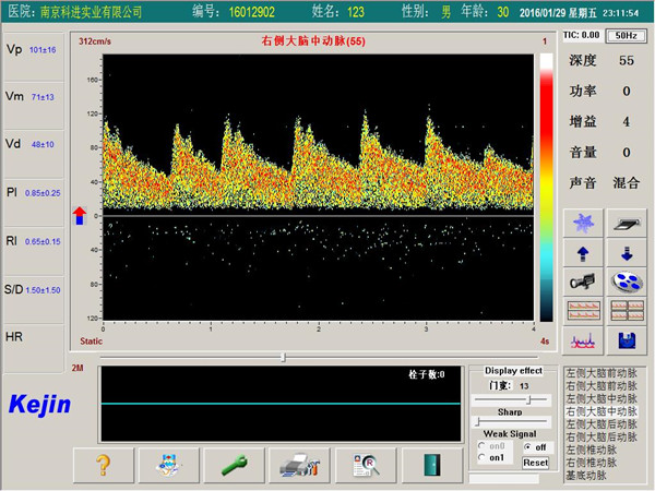 1530078256580401.jpg PW模式下單窗口檢測界面.jpg