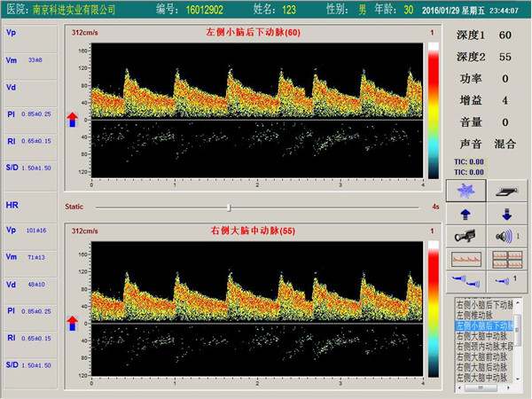 經顱多普勒雙通道，單深度界面