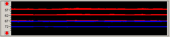 1533192089973719.jpg 超聲經顱多普勒血流分析儀M模顯示窗口圖.jpg