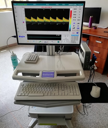 金華市金三角醫院引入經顱多普勒KJ-2V6M