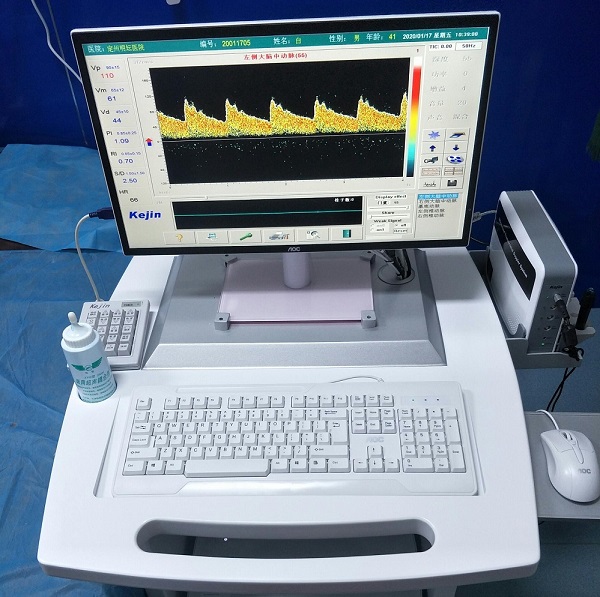 超聲經顱多普勒血流分析儀的缺點是什么