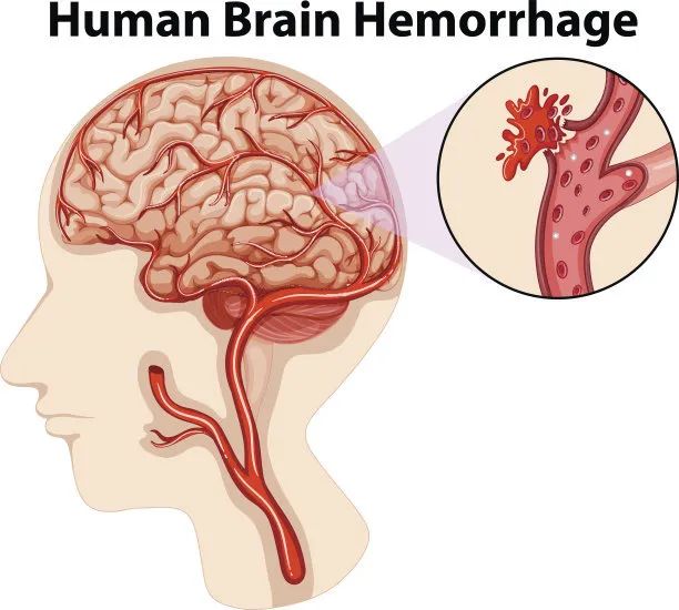 超聲經顱多普勒(TCD)檢測儀該如何使用 超聲經顱多普勒(TCD)檢測儀該如何使用